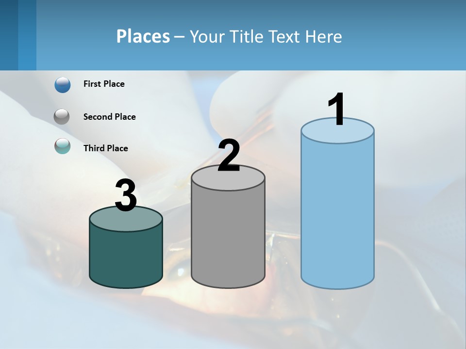 Health Retina Suture PowerPoint Template