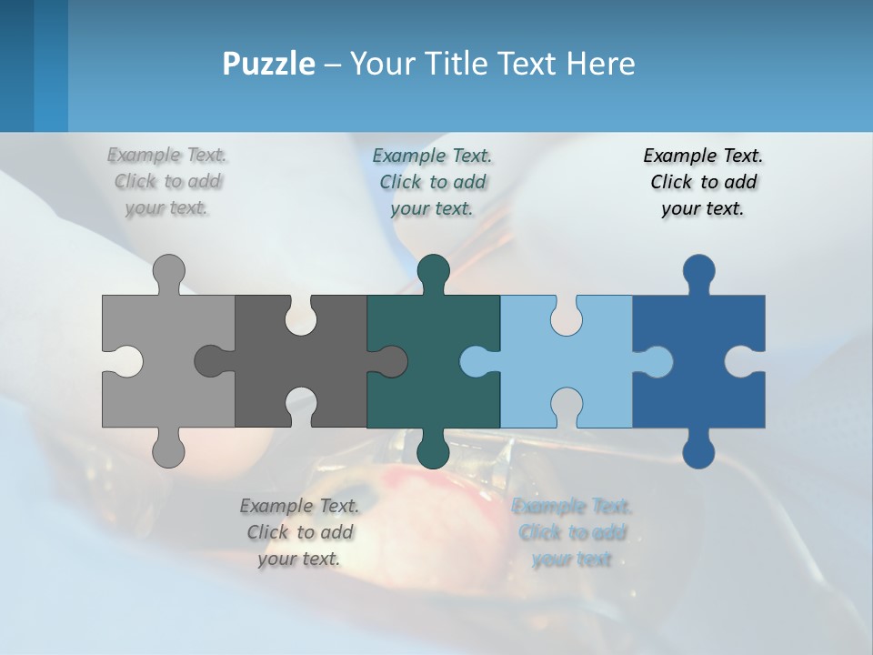 Health Retina Suture PowerPoint Template