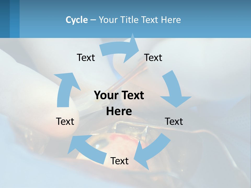 Health Retina Suture PowerPoint Template