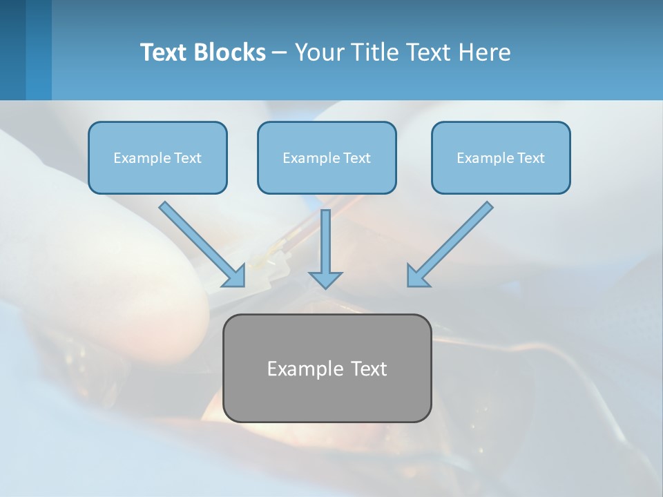 Health Retina Suture PowerPoint Template