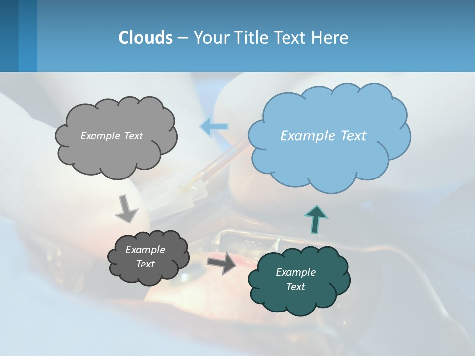 Health Retina Suture PowerPoint Template