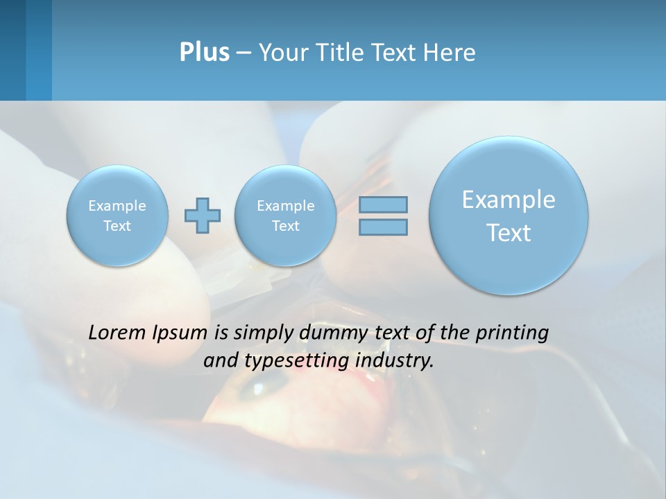 Health Retina Suture PowerPoint Template