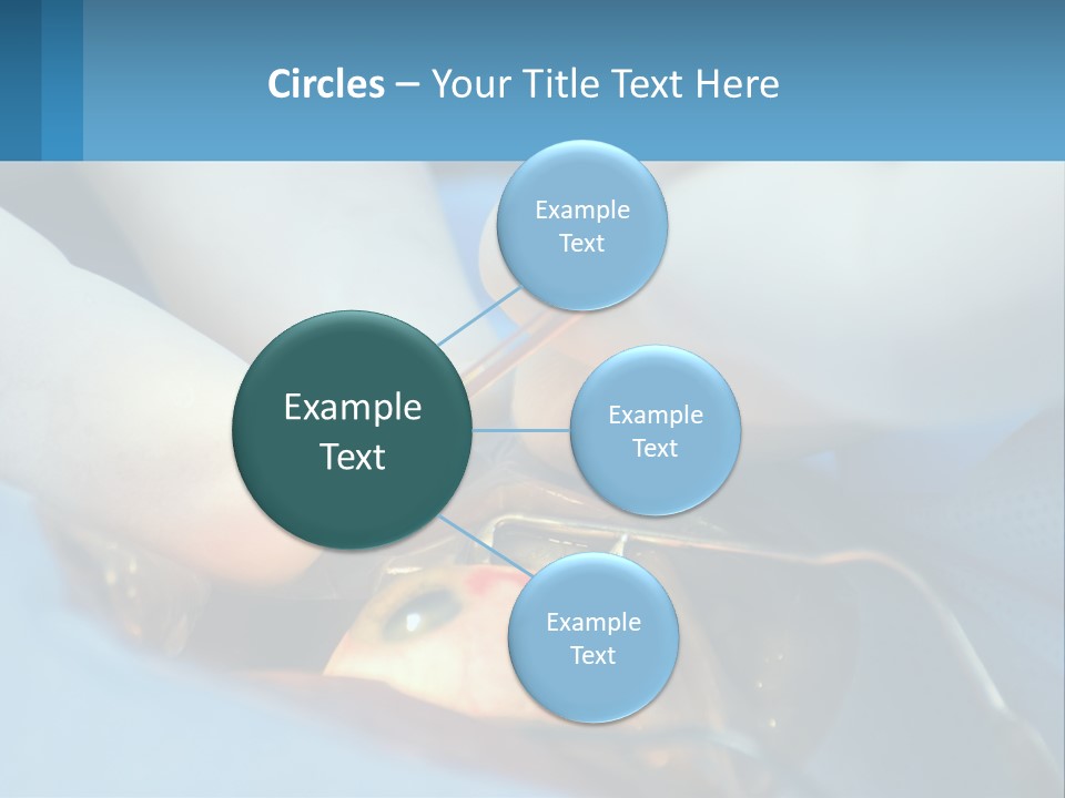 Health Retina Suture PowerPoint Template
