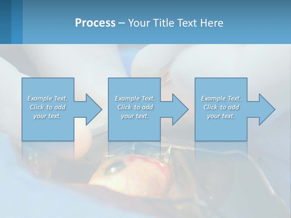 Health Retina Suture PowerPoint Template