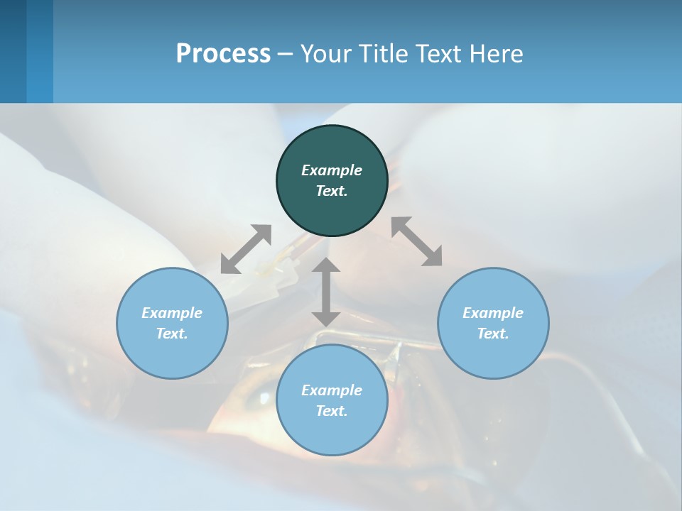 Health Retina Suture PowerPoint Template