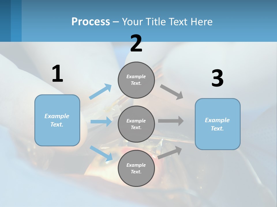 Health Retina Suture PowerPoint Template