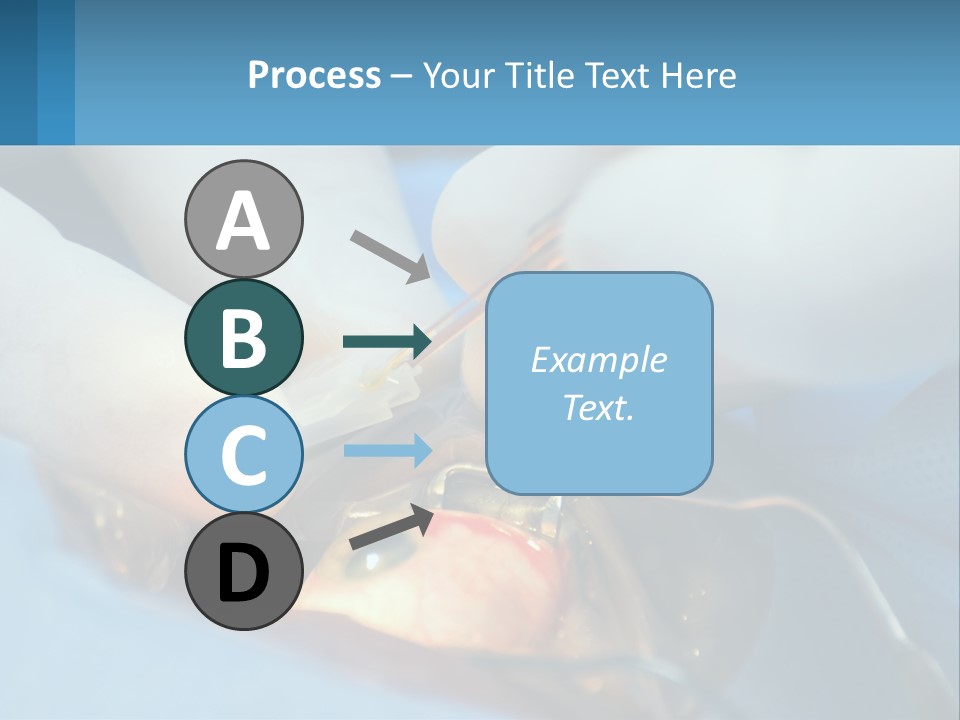 Health Retina Suture PowerPoint Template