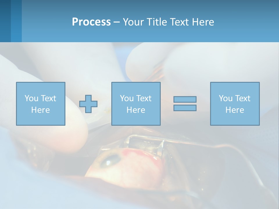 Health Retina Suture PowerPoint Template