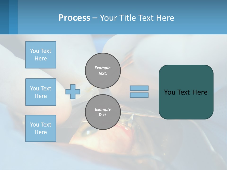 Health Retina Suture PowerPoint Template
