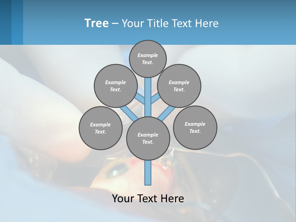 Health Retina Suture PowerPoint Template
