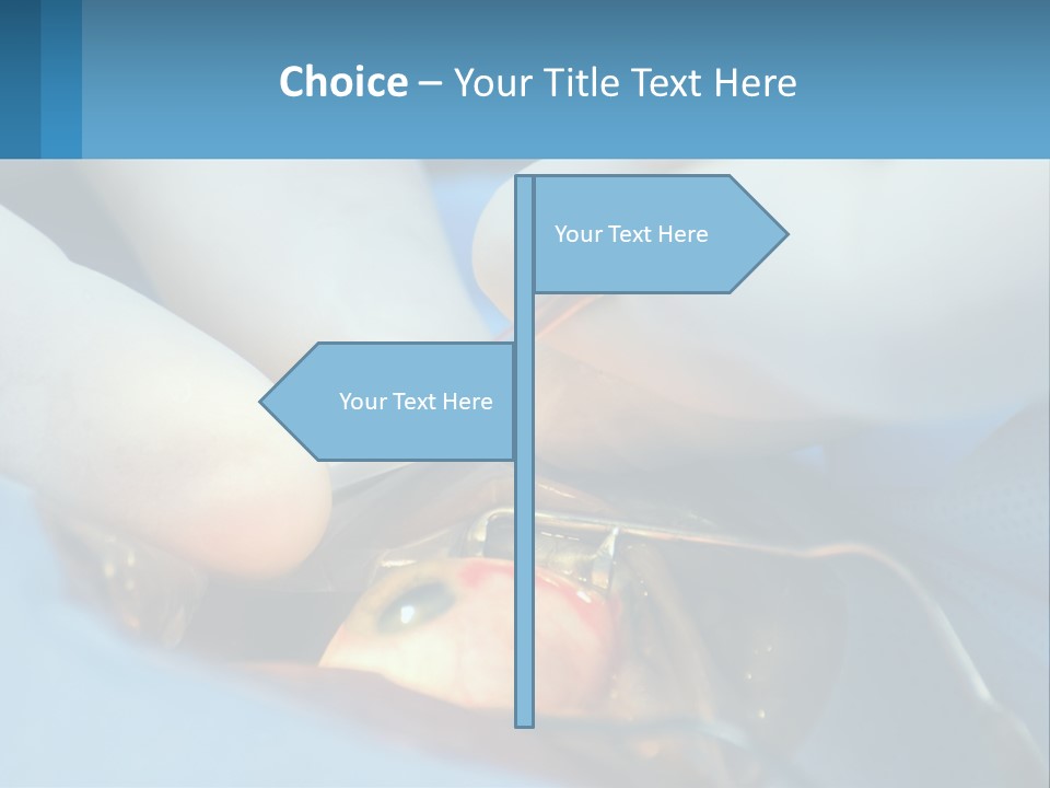 Health Retina Suture PowerPoint Template