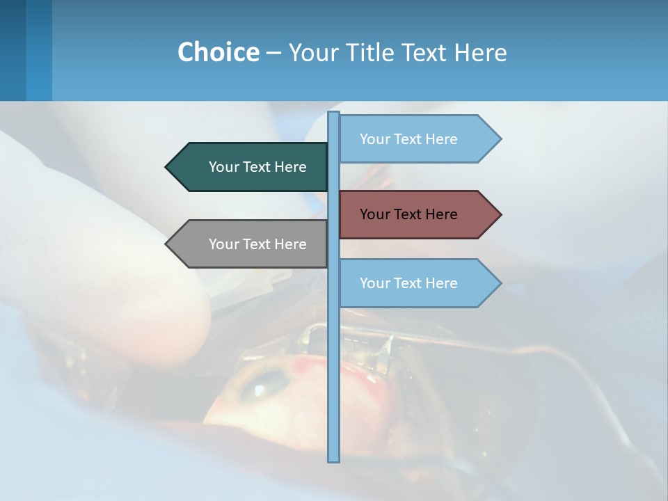 Health Retina Suture PowerPoint Template