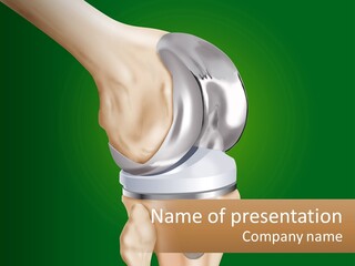 Knee Tibia Medicine PowerPoint Template