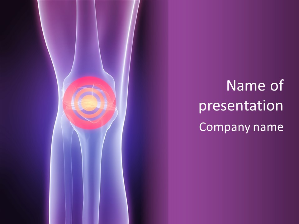 Medical Arthritis Anatomy PowerPoint Template