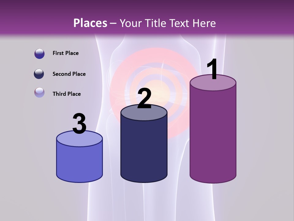 Medical Arthritis Anatomy PowerPoint Template