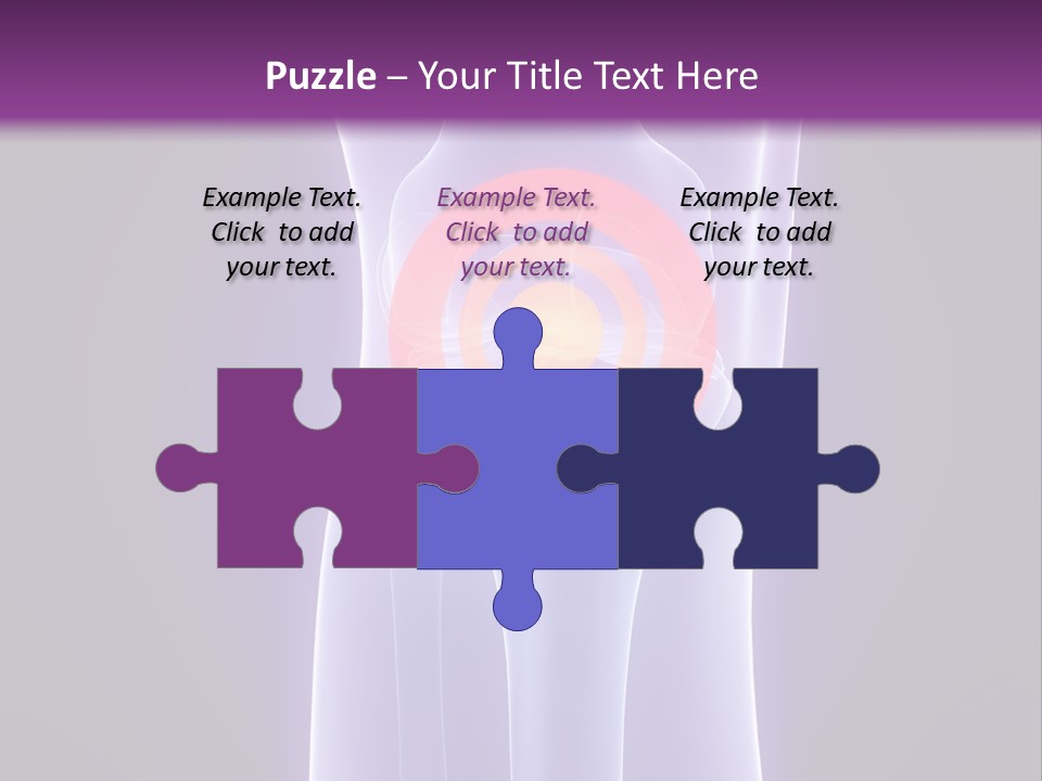 Medical Arthritis Anatomy PowerPoint Template