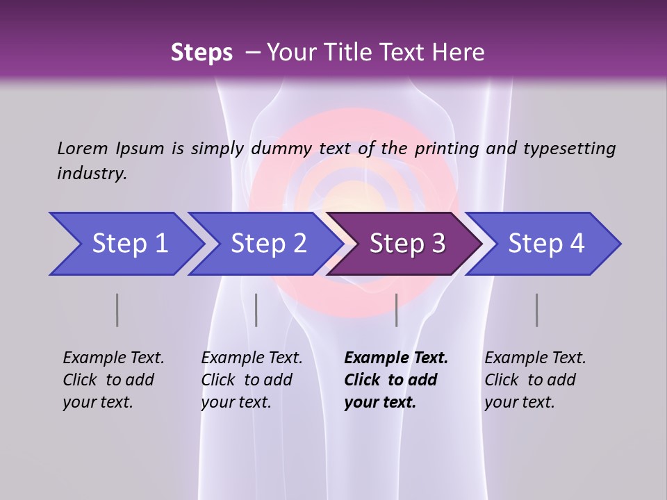 Medical Arthritis Anatomy PowerPoint Template