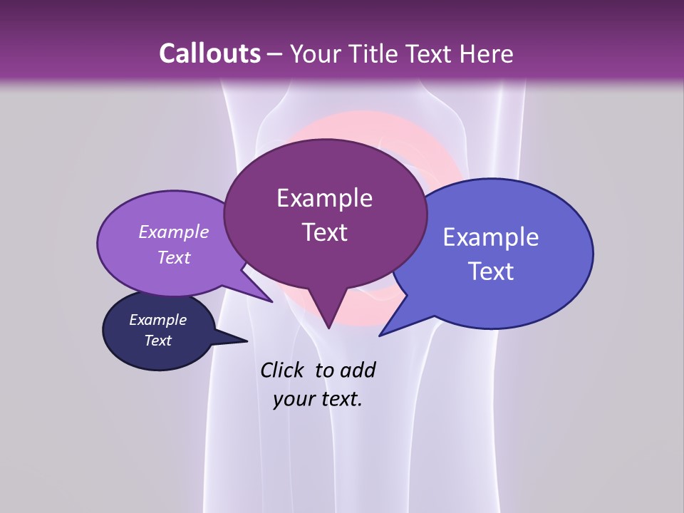 Medical Arthritis Anatomy PowerPoint Template
