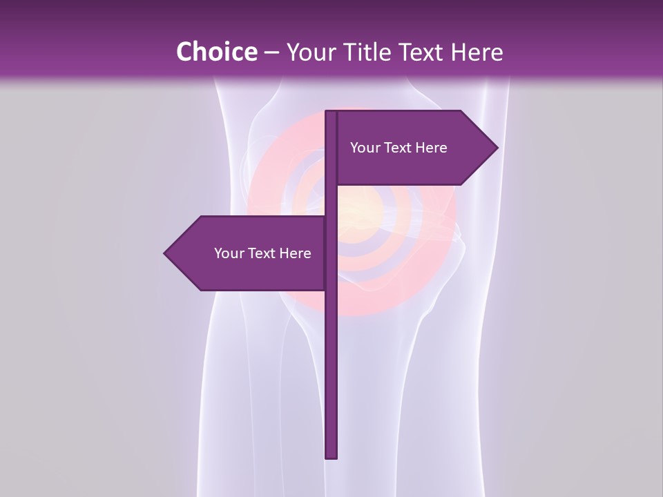 Medical Arthritis Anatomy PowerPoint Template