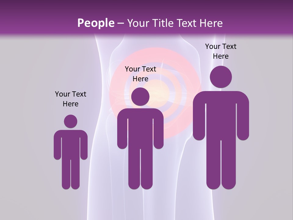 Medical Arthritis Anatomy PowerPoint Template