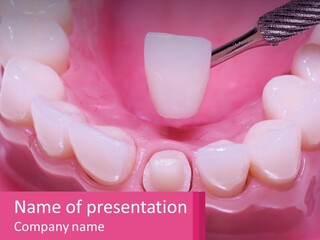 Dentistry Fake Sintered PowerPoint Template