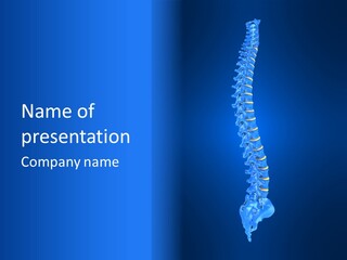 Arthritis Skeleton Spinal PowerPoint Template
