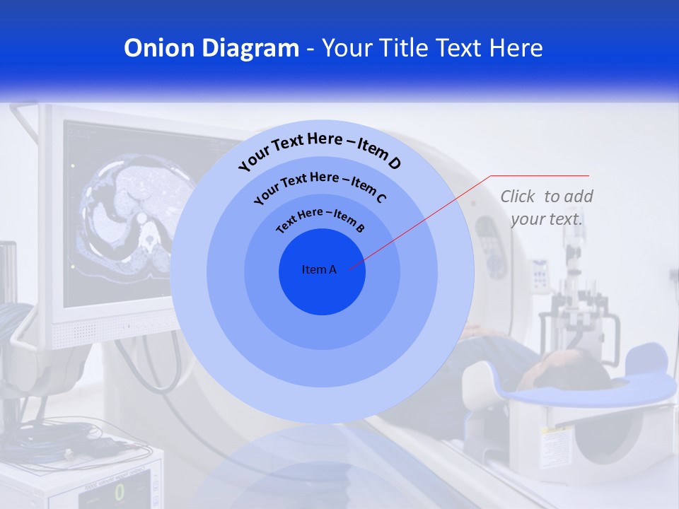 A Man Laying In A Hospital Bed In Front Of A Monitor PowerPoint Template