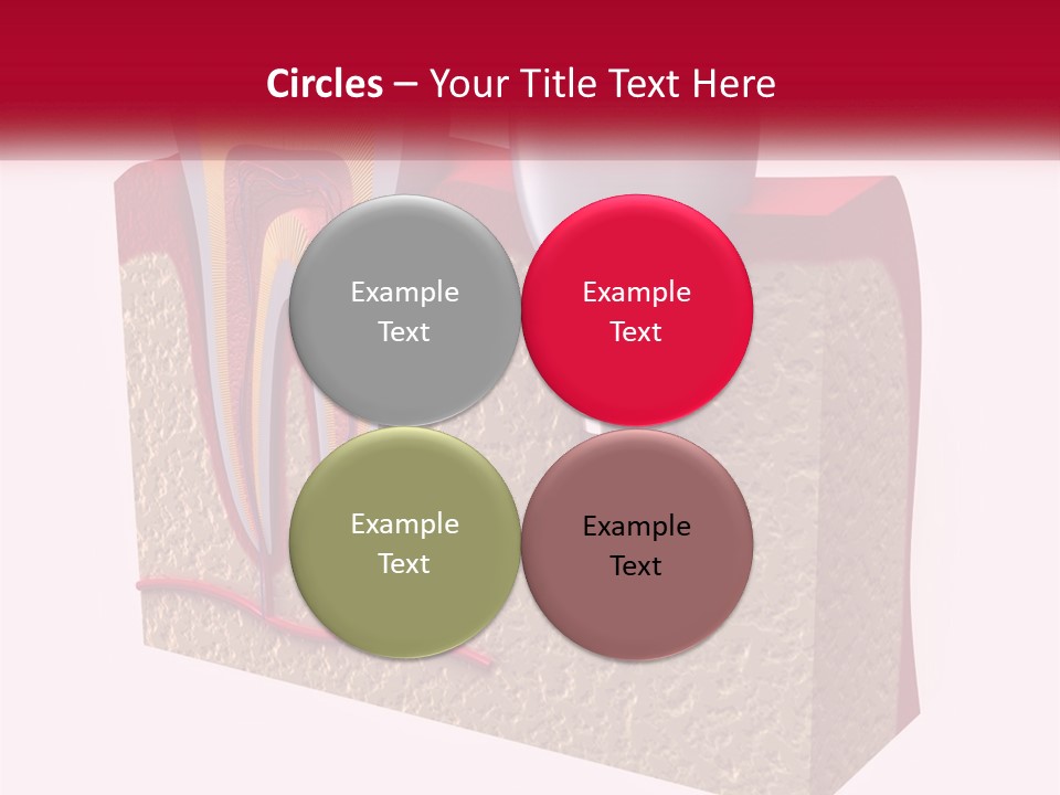 A Tooth With A Dental Implant On Top Of It PowerPoint Template