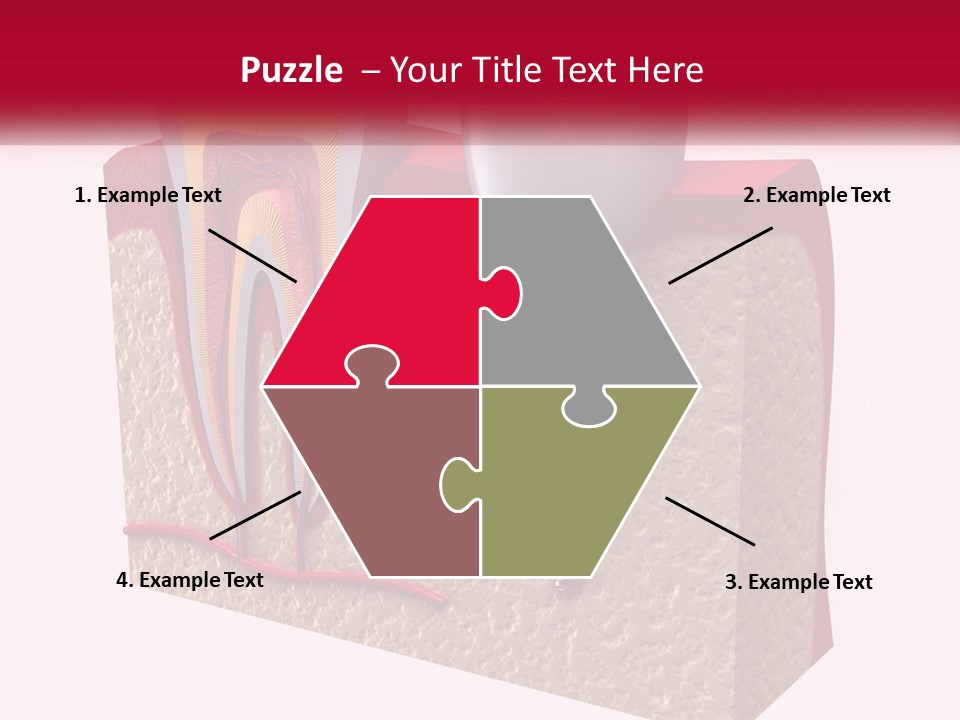 A Tooth With A Dental Implant On Top Of It PowerPoint Template