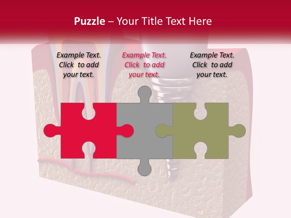 A Tooth With A Dental Implant On Top Of It PowerPoint Template