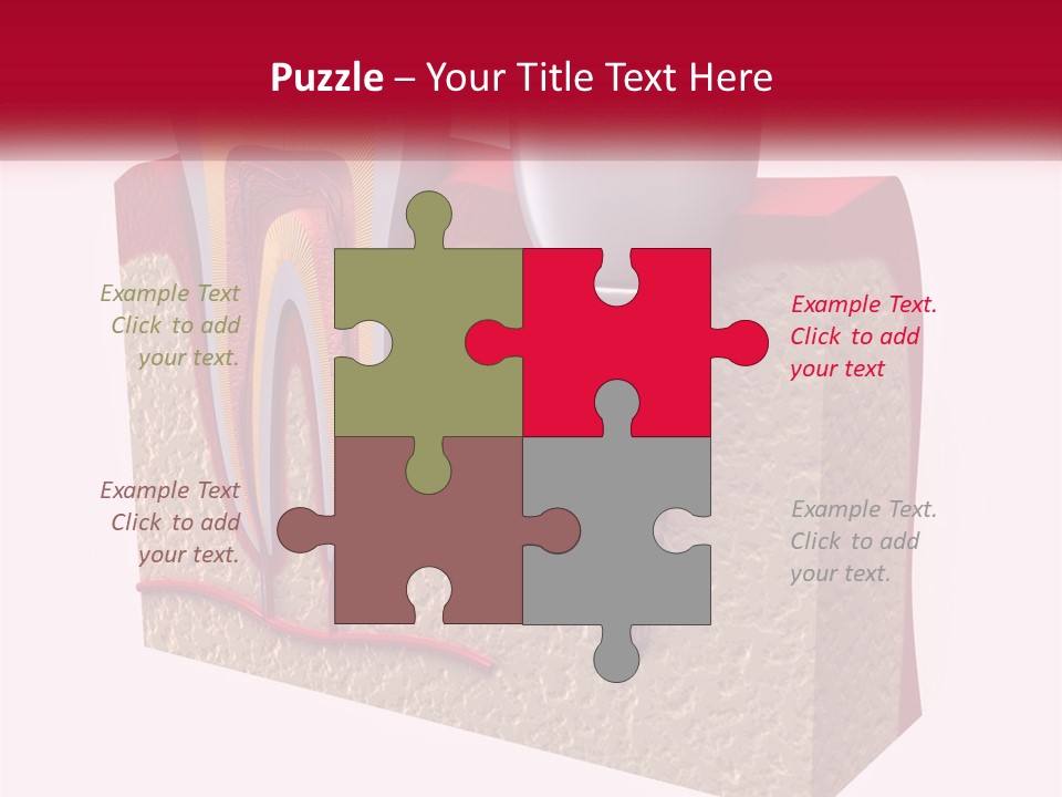 A Tooth With A Dental Implant On Top Of It PowerPoint Template