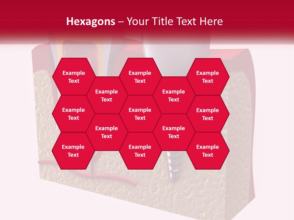 A Tooth With A Dental Implant On Top Of It PowerPoint Template