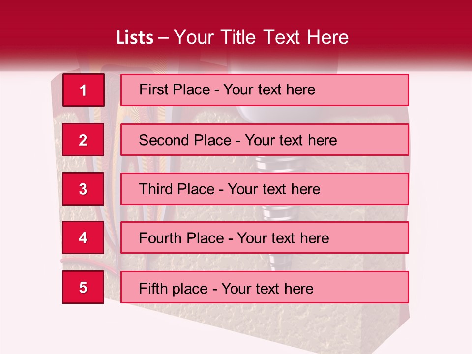 A Tooth With A Dental Implant On Top Of It PowerPoint Template