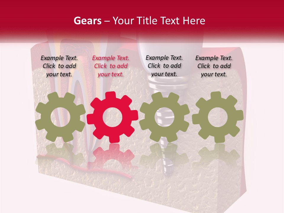 A Tooth With A Dental Implant On Top Of It PowerPoint Template