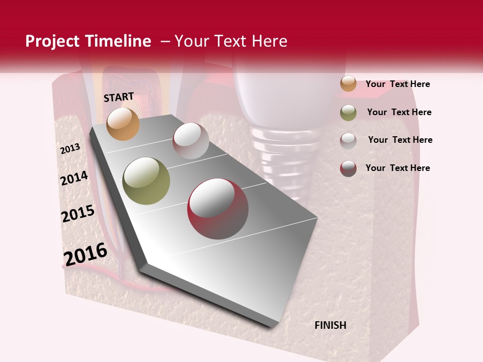 A Tooth With A Dental Implant On Top Of It PowerPoint Template