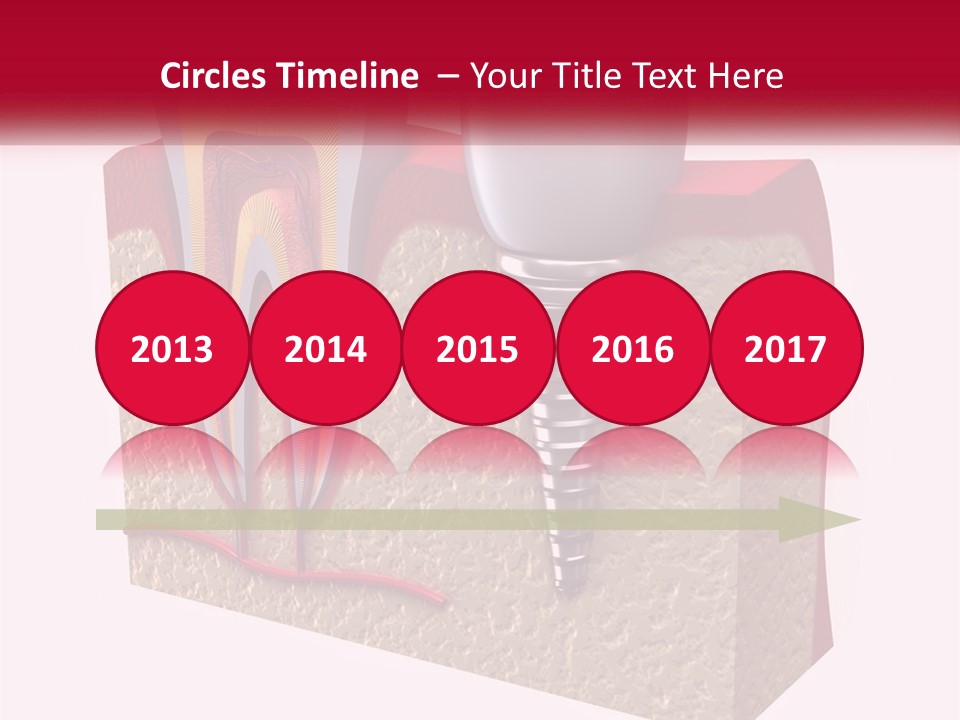 A Tooth With A Dental Implant On Top Of It PowerPoint Template