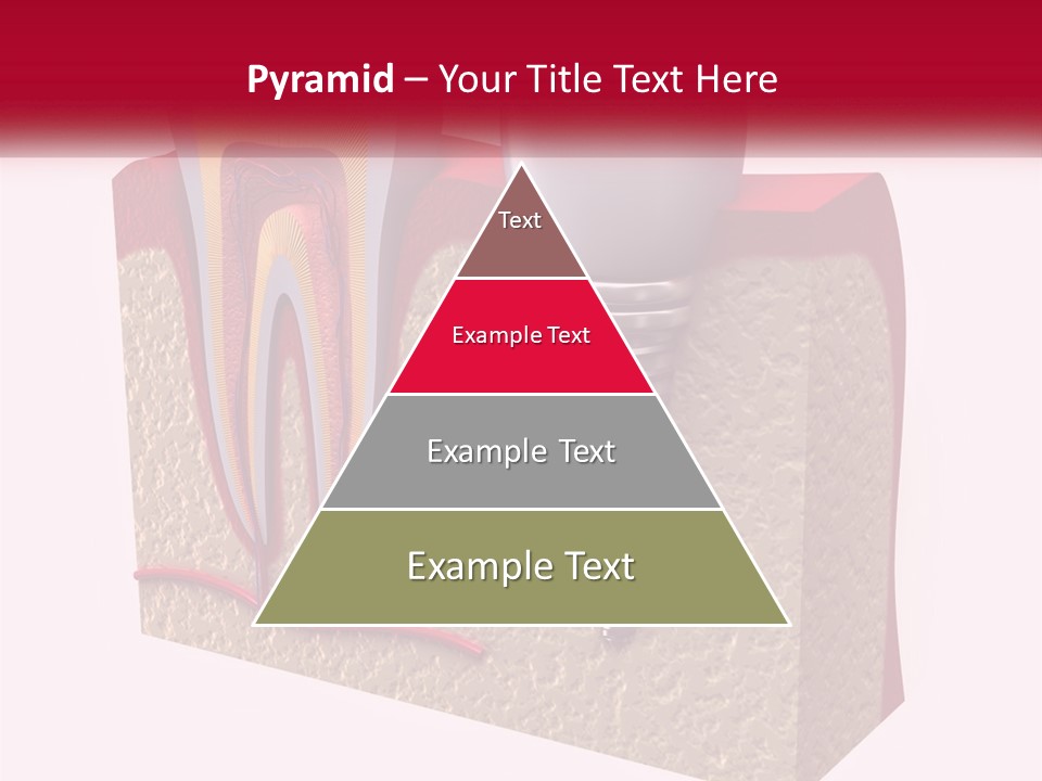 A Tooth With A Dental Implant On Top Of It PowerPoint Template