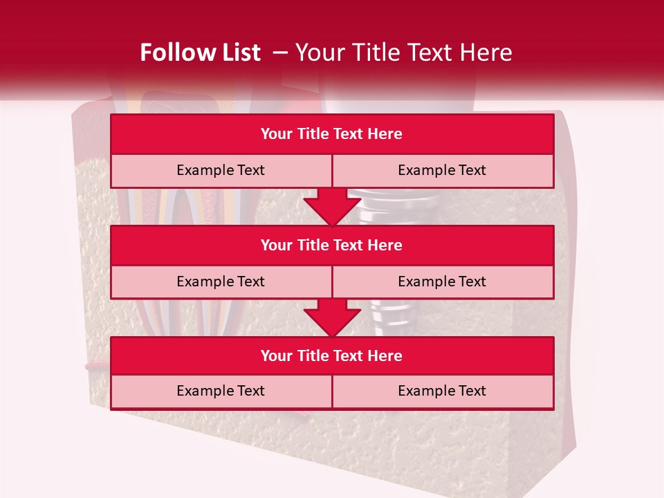 A Tooth With A Dental Implant On Top Of It PowerPoint Template