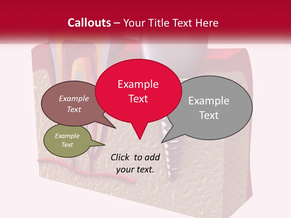 A Tooth With A Dental Implant On Top Of It PowerPoint Template