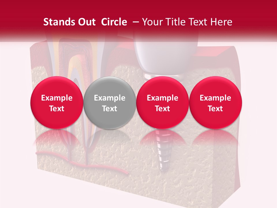 A Tooth With A Dental Implant On Top Of It PowerPoint Template