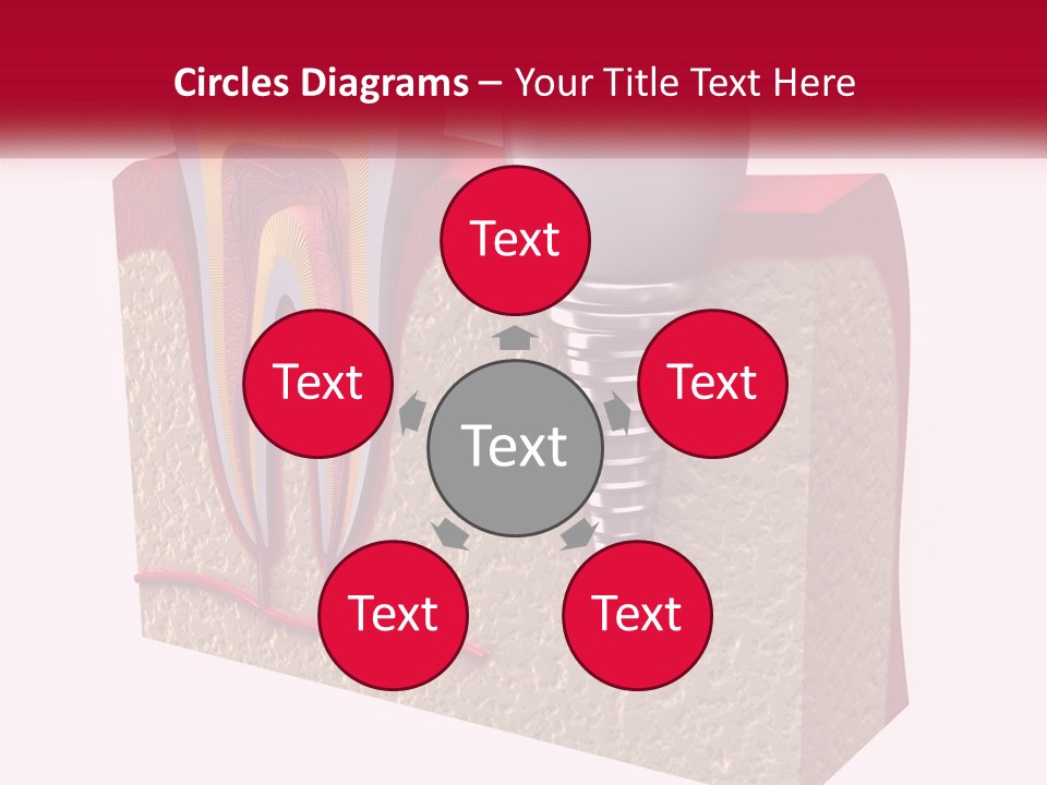 A Tooth With A Dental Implant On Top Of It PowerPoint Template