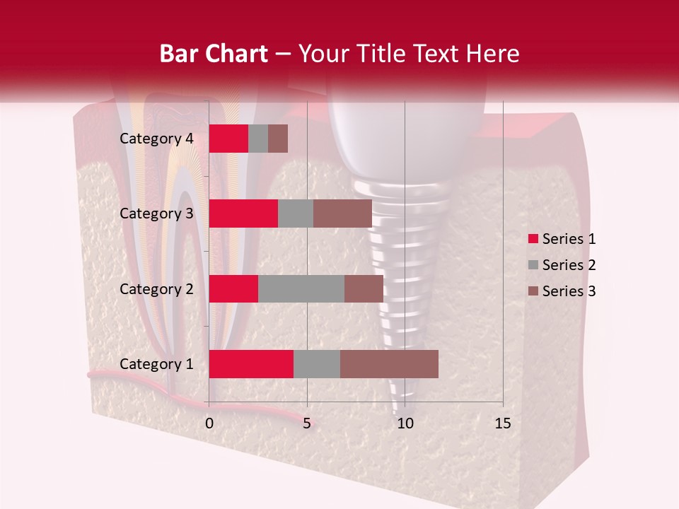 A Tooth With A Dental Implant On Top Of It PowerPoint Template