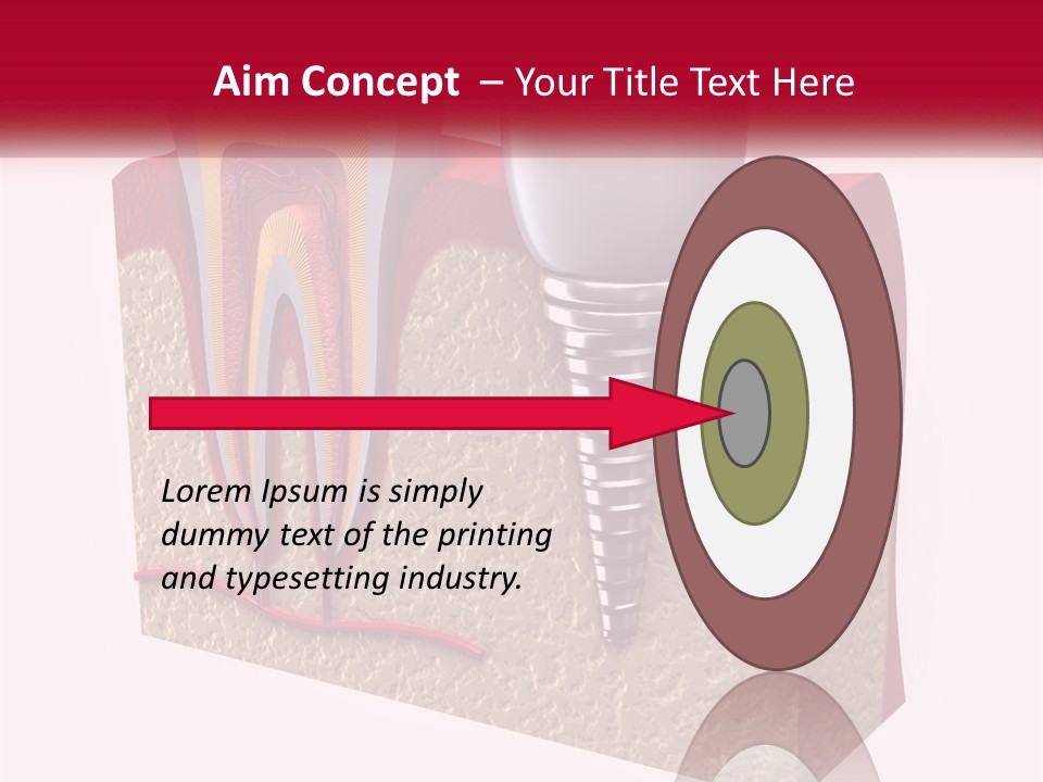 A Tooth With A Dental Implant On Top Of It PowerPoint Template