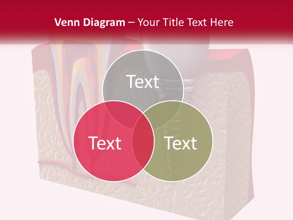 A Tooth With A Dental Implant On Top Of It PowerPoint Template