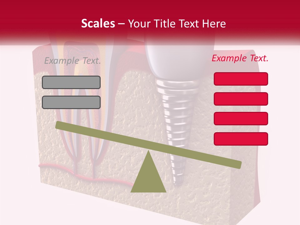 A Tooth With A Dental Implant On Top Of It PowerPoint Template