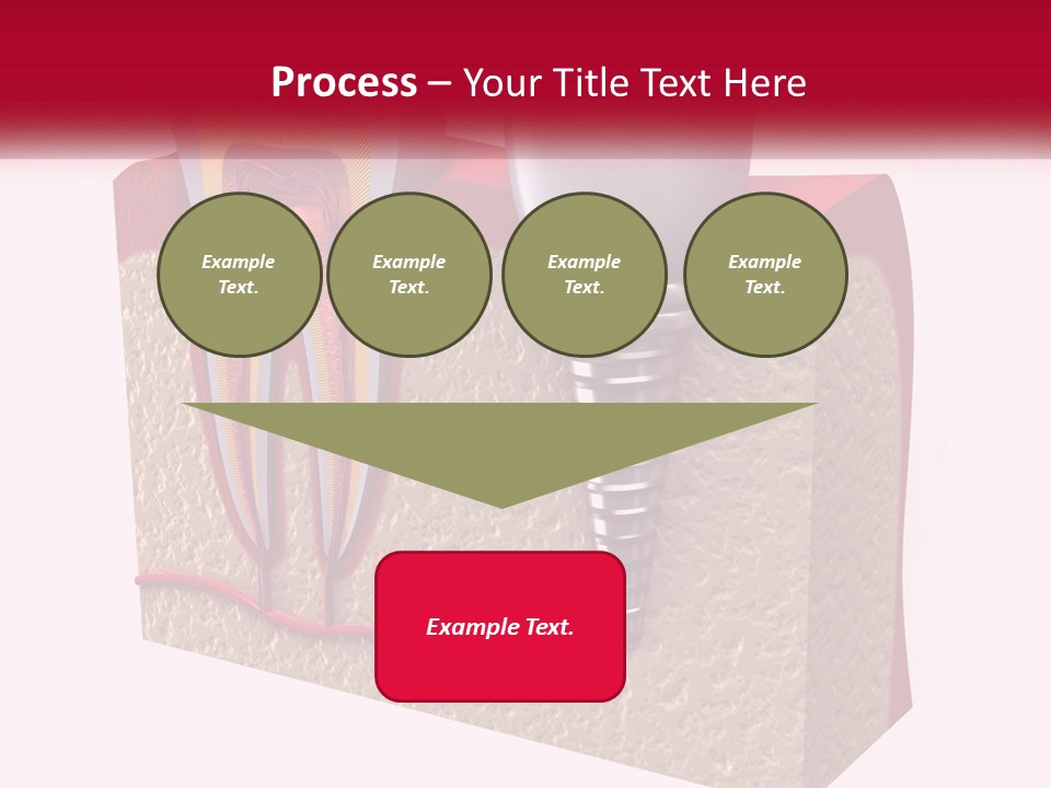 A Tooth With A Dental Implant On Top Of It PowerPoint Template