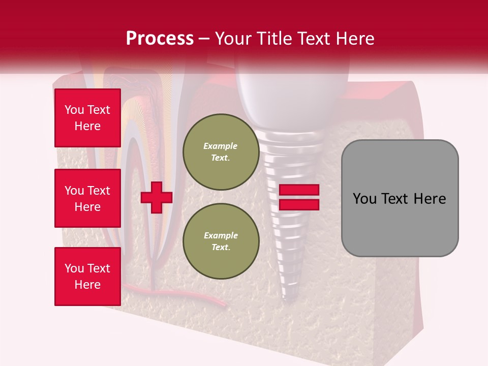 A Tooth With A Dental Implant On Top Of It PowerPoint Template