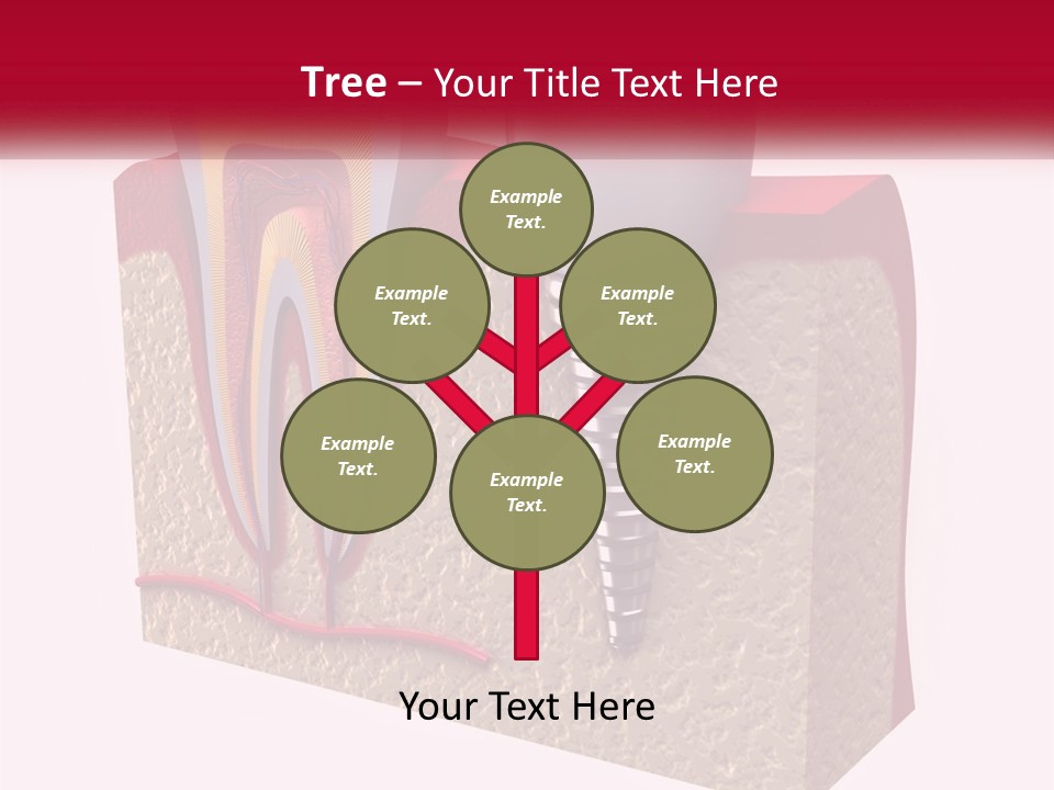 A Tooth With A Dental Implant On Top Of It PowerPoint Template