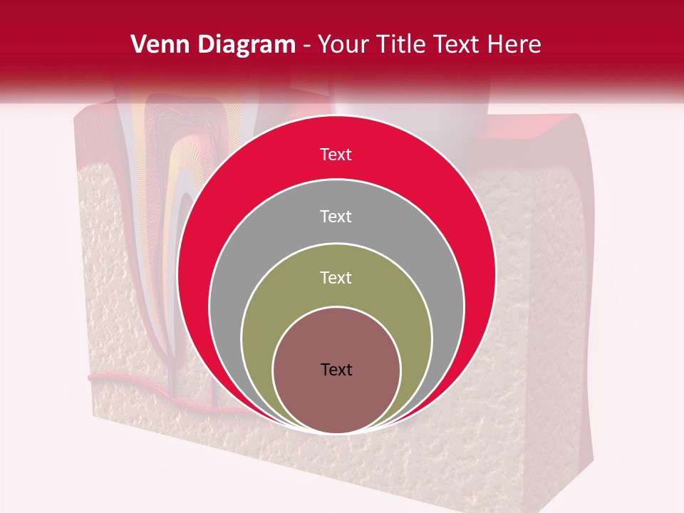 A Tooth With A Dental Implant On Top Of It PowerPoint Template