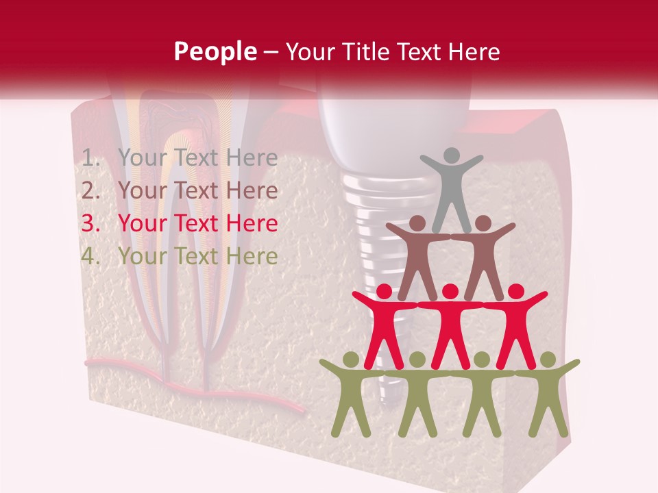 A Tooth With A Dental Implant On Top Of It PowerPoint Template